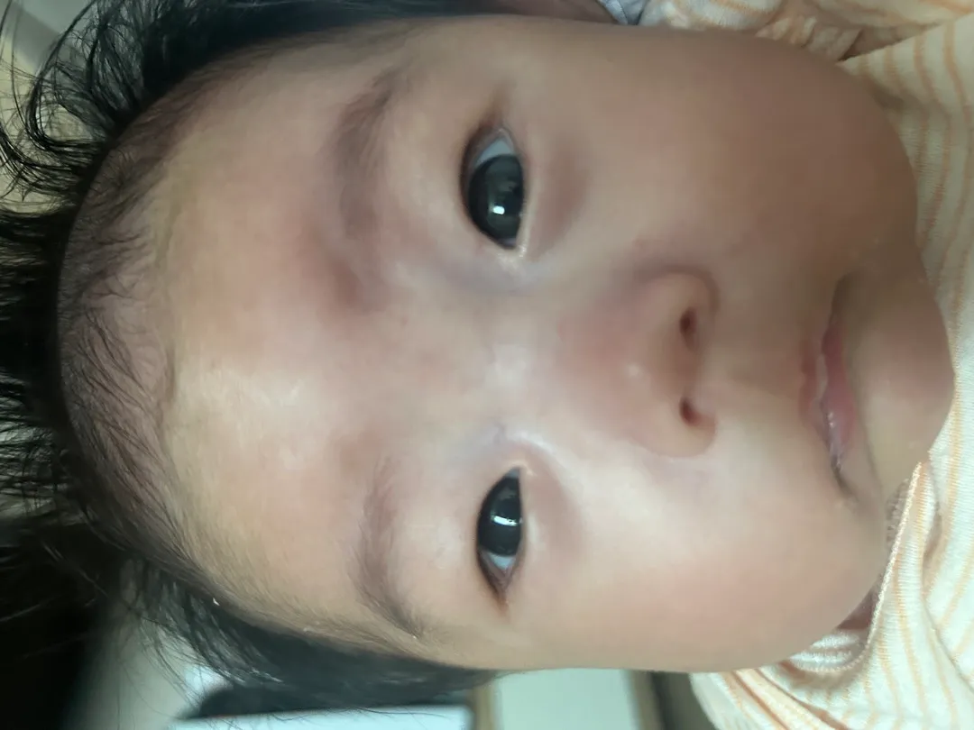아기 다래끼일까요??ㅜㅜ