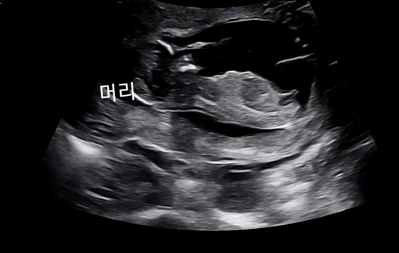 12주 각도법 아무리봐도 모르겠어요ㅠㅠ도와쥬세염...