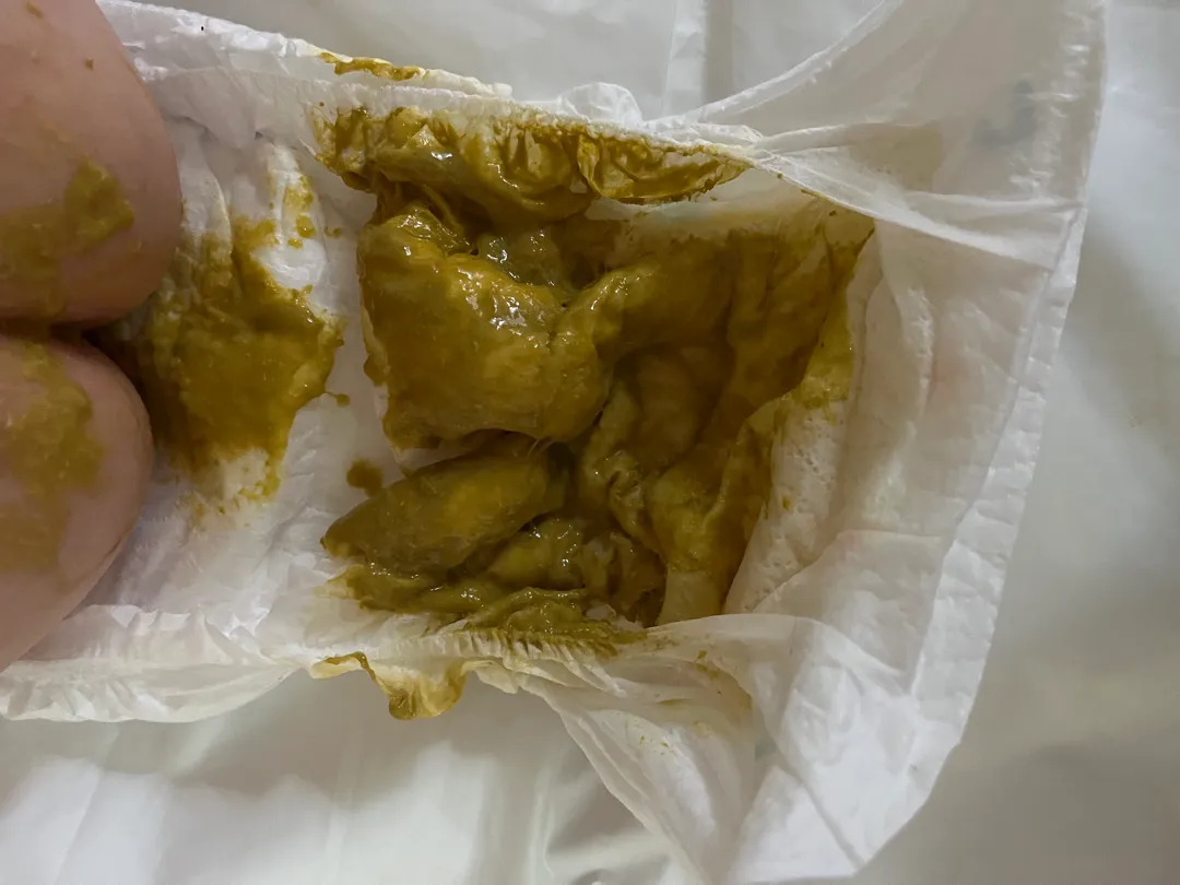 아기 변 좀 봐주세요 (매너사진 X)