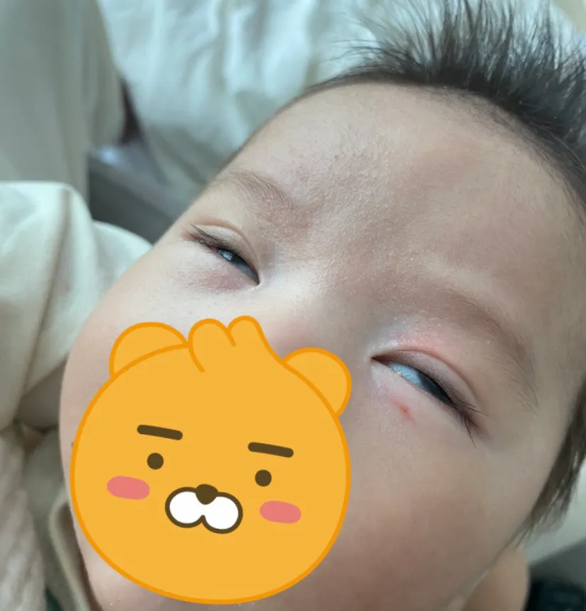 아기 쌍커플이요~