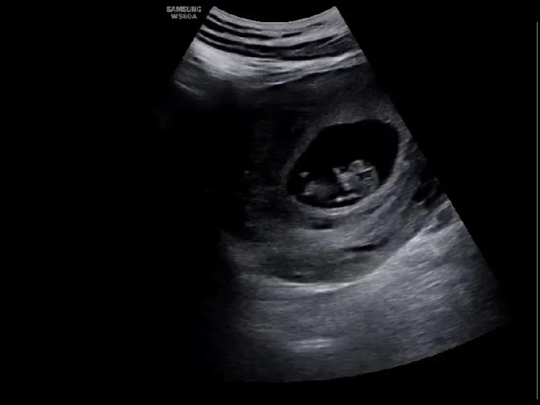 10주차 꿀떡입니다!👶