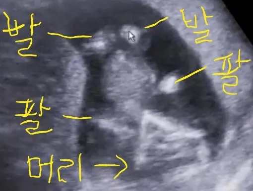 각도법좀 봐주세요ㅜㅜㅜ