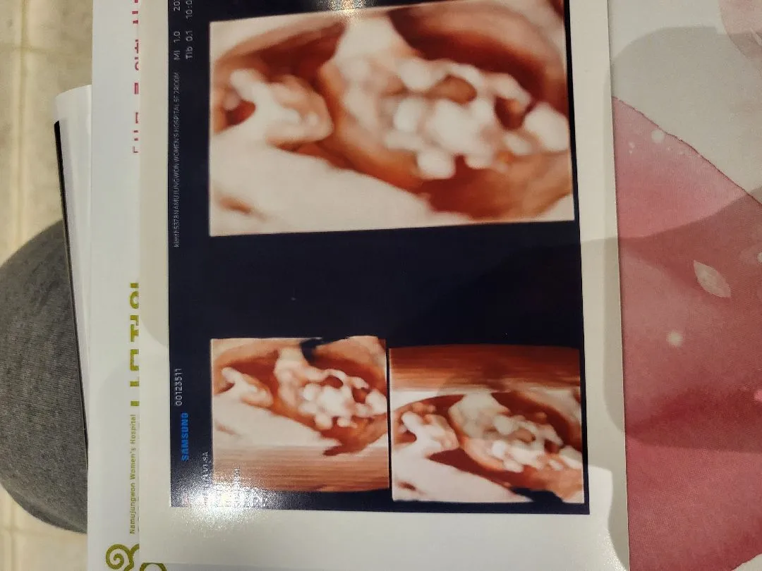 입체초음파보구왔어요