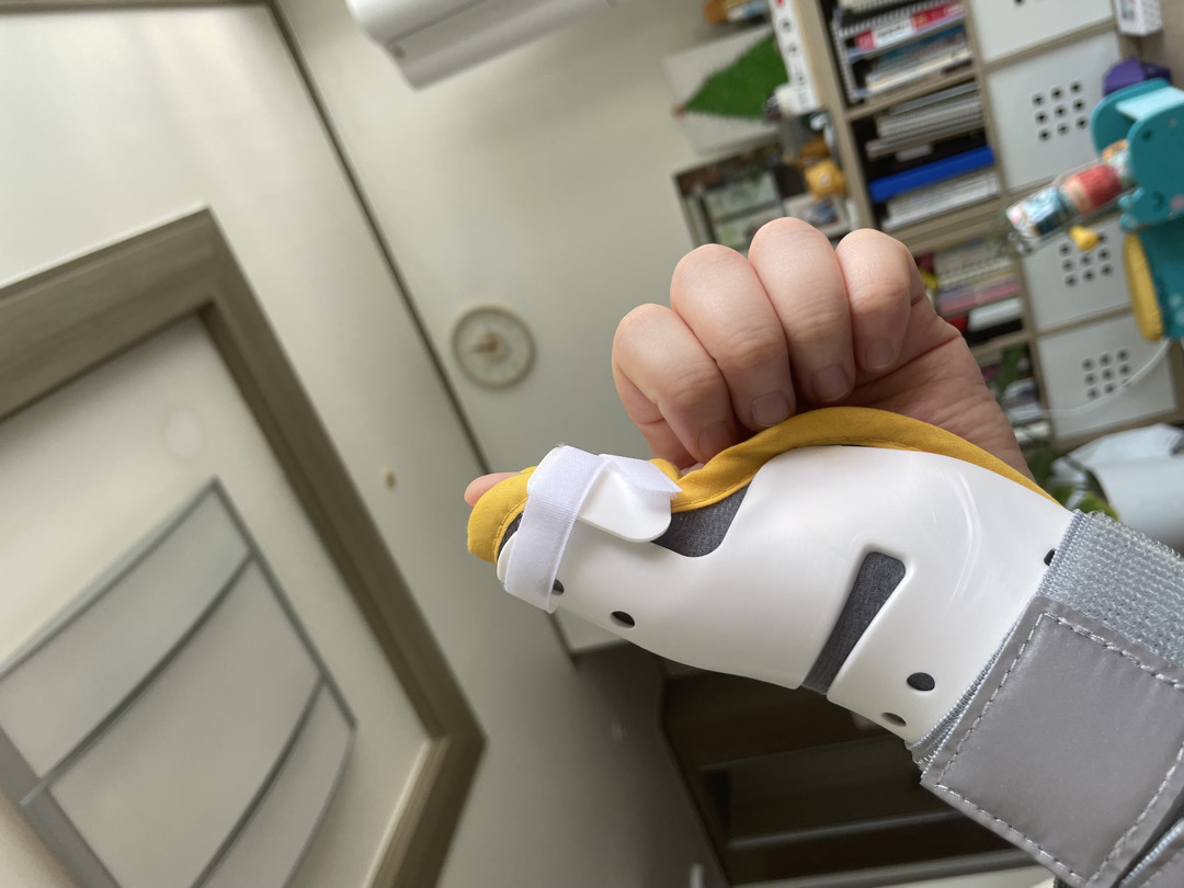 출산 전부터 손목통증, 건초염 오신 분..?