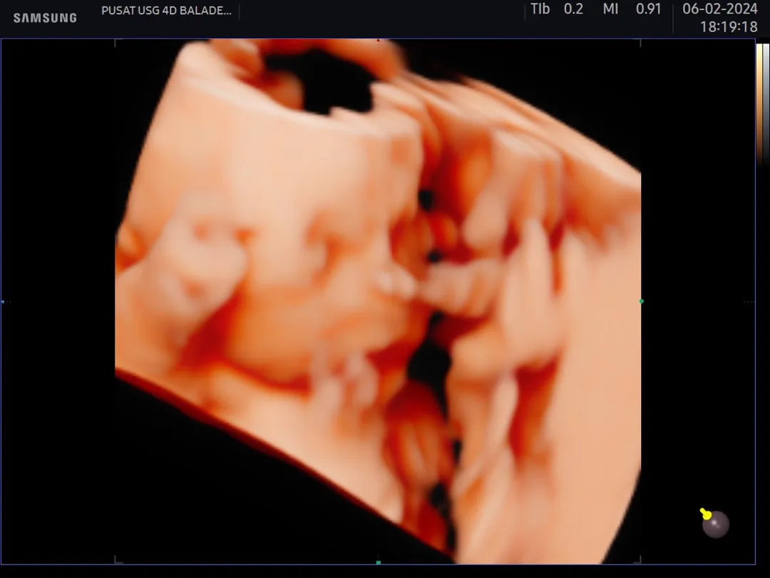 Penasaran ga sih wajah bayi dlm perut kita #aibilly