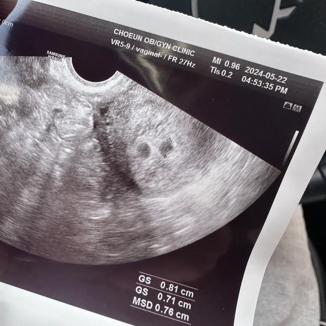 쌍둥이 난황언제쯤,,