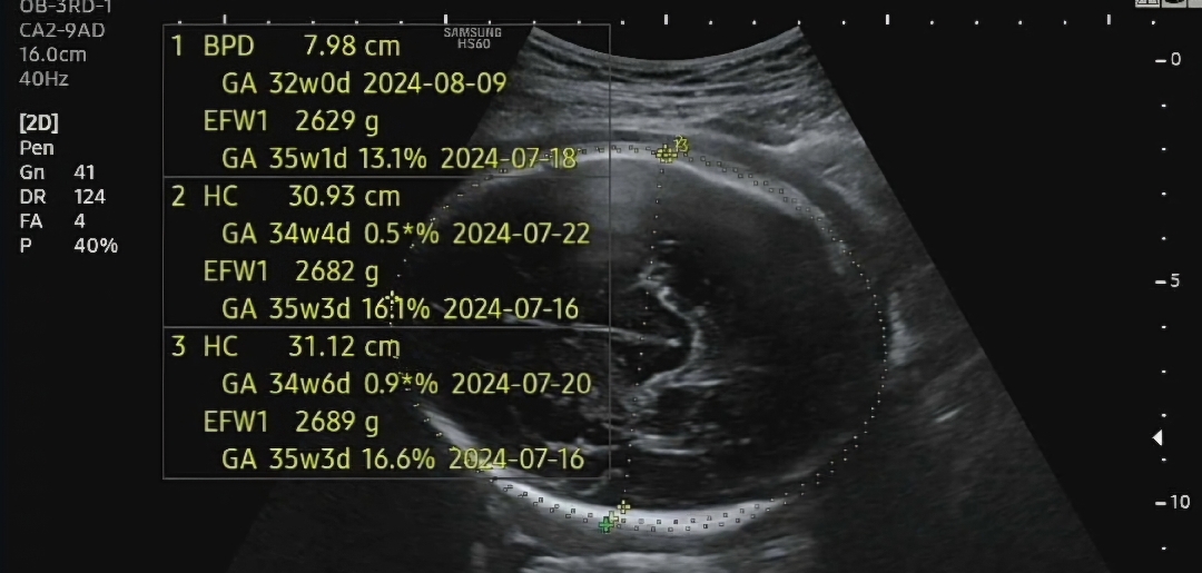 머리가 많이 작아서 빨리 꺼내야한데여..