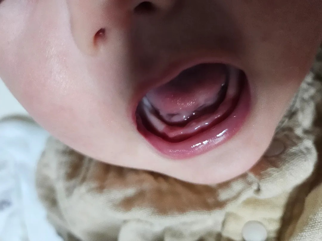 이거 치아 맞나요??