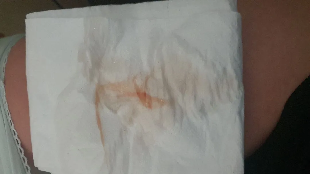 이것이 이슬비친걸까요?