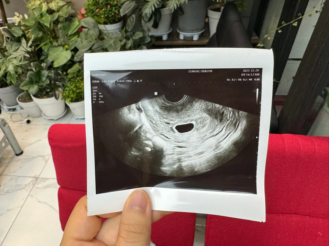 6주차 반인것 같은데 계류유산 의심되는데 초음파 사진 봐주세요~ㅠㅠ