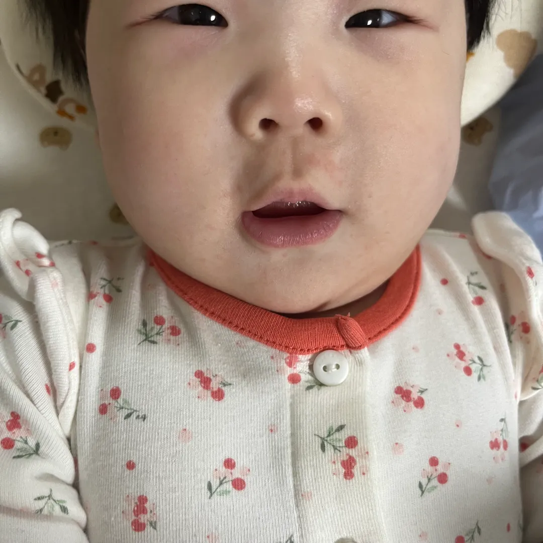 알러지일까요?