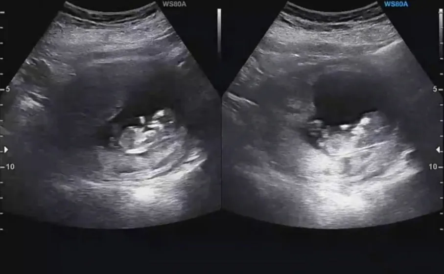 오늘이 딱 11주 단감이 보고왔어요 ^^