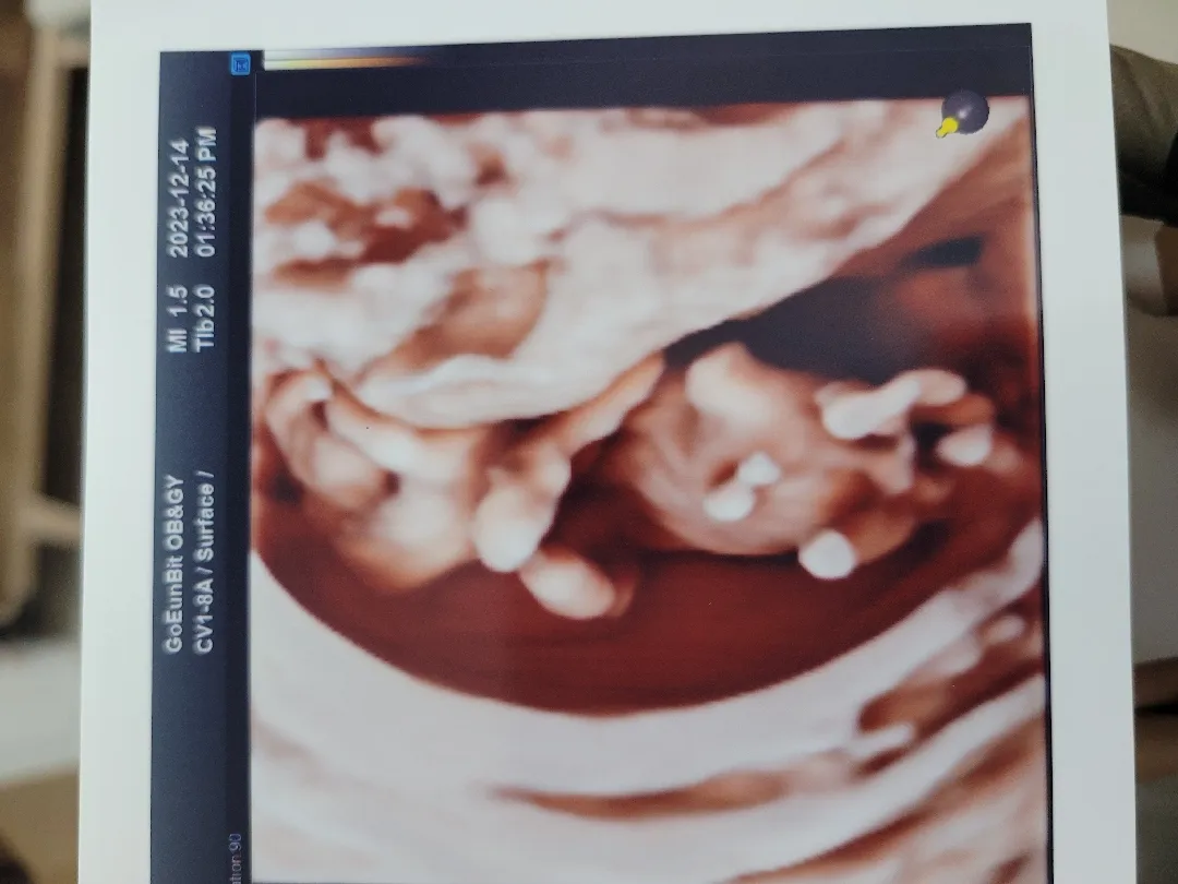입초로 성별 알수있나요??