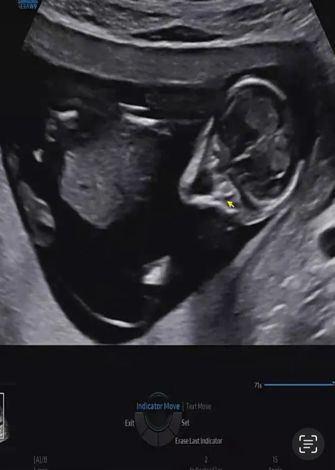 밑부분에 혹시 🌶️인가요?? 12주 입니다..!!!(수정)