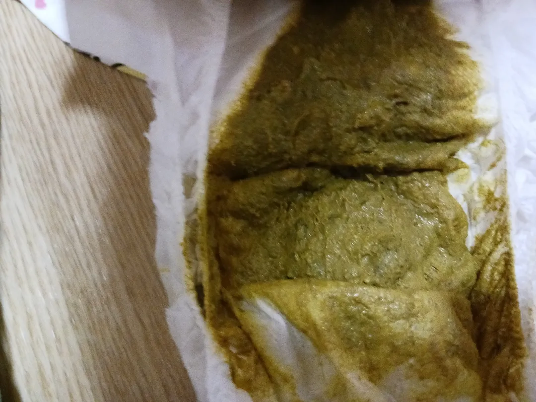 저희애기 변사진 괜찮은건가요