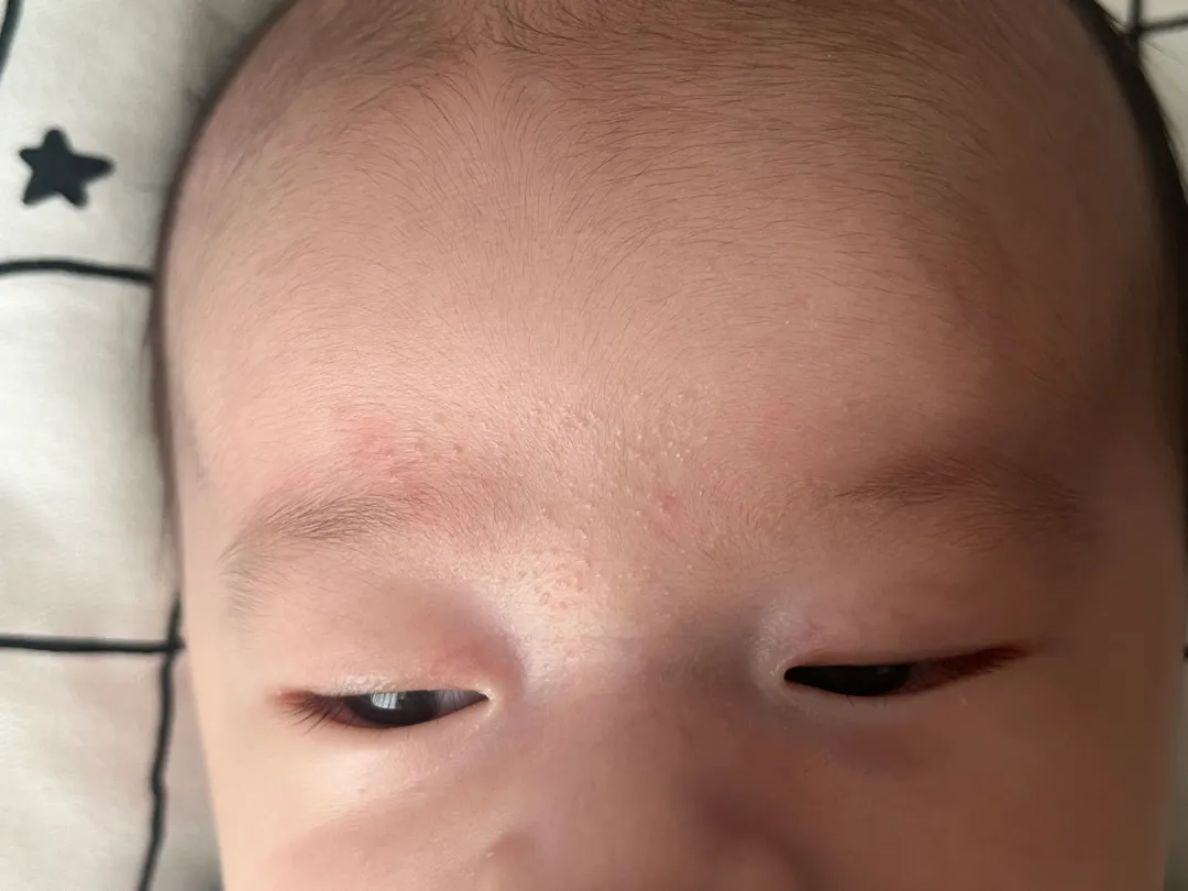 태열인가요?ㅜㅜ