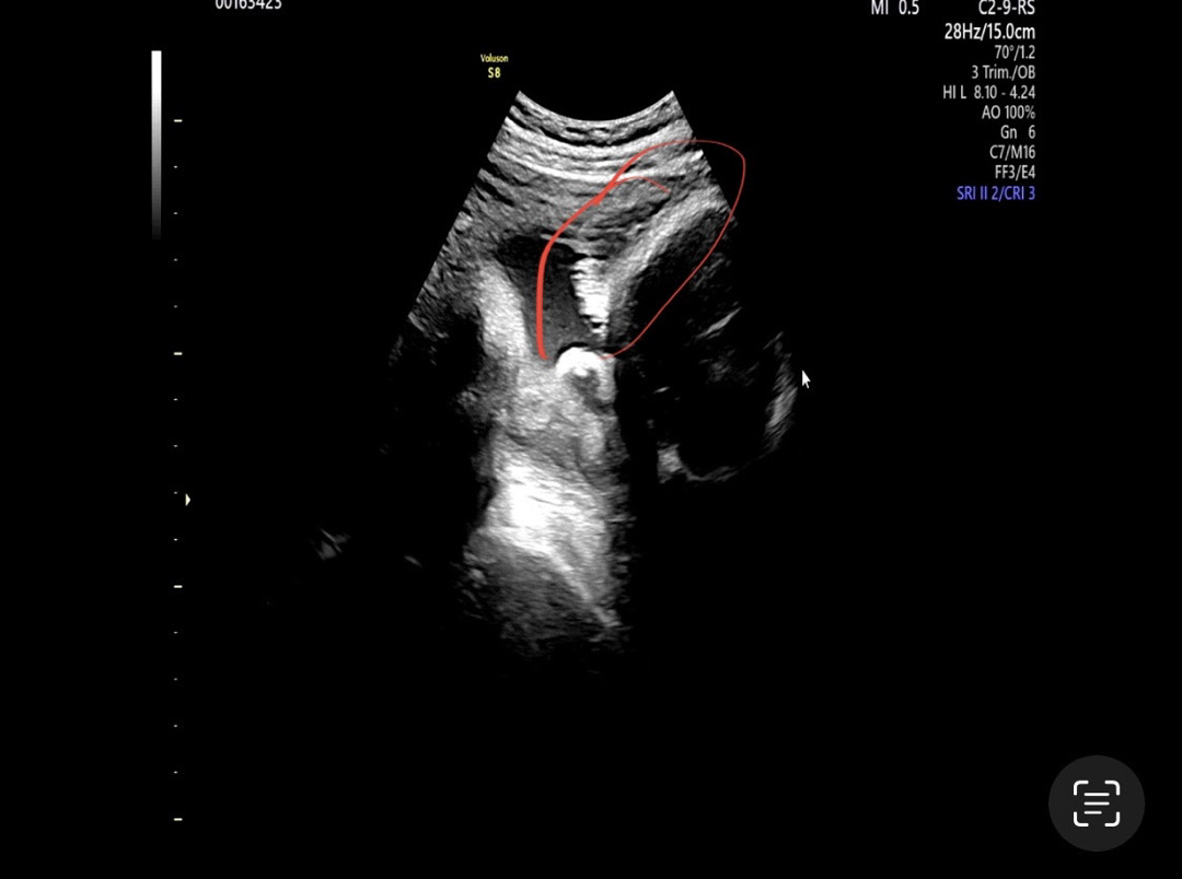 머리카락 너무 신기해요ㅎㅎ 머리숱많은거겠죠?