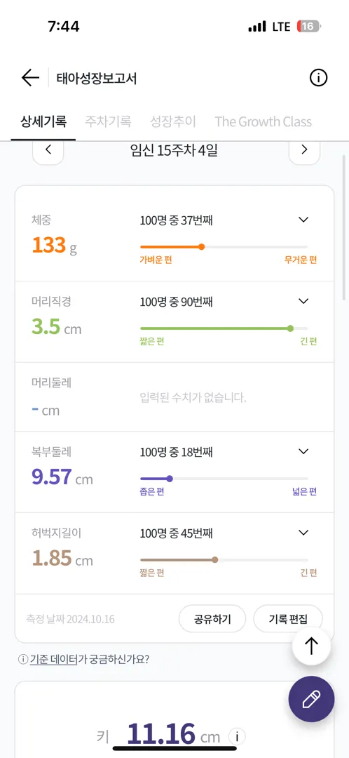애기 머리크기..