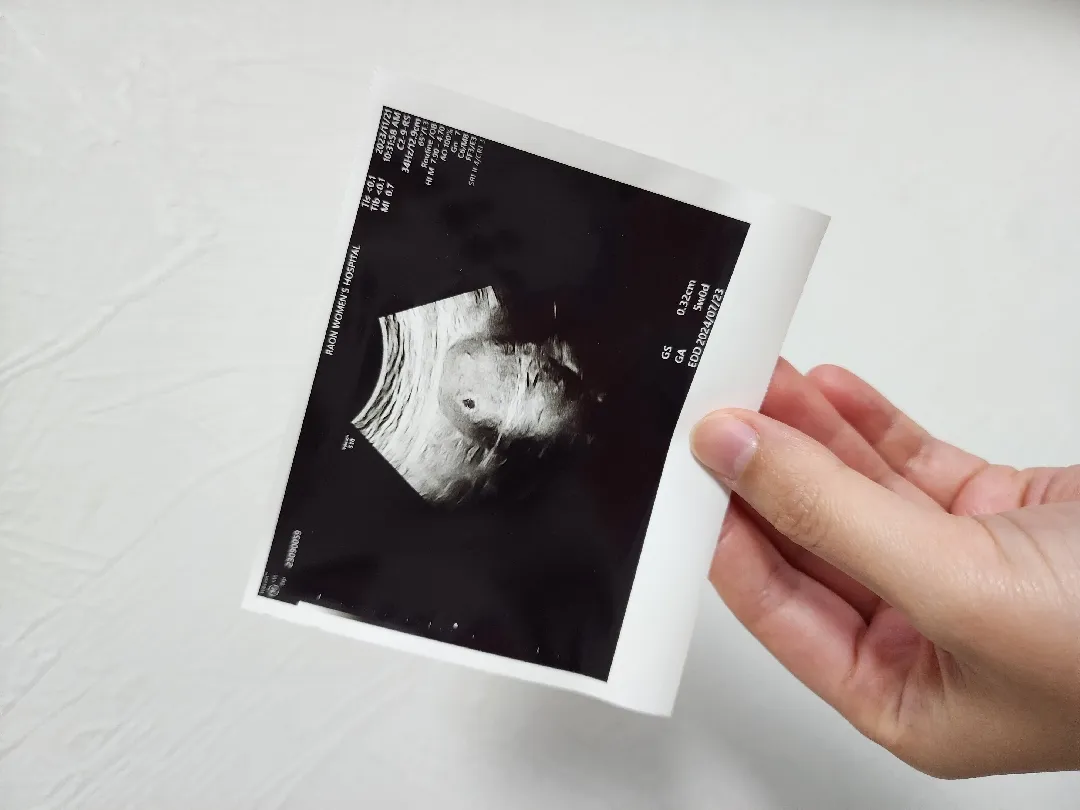 4주6일차 아기집 보고왔어요