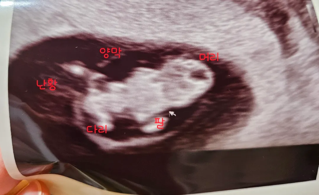 벌써 쩍벌 모습 보여준 우리 아기ㅋㅋㅋㅋ