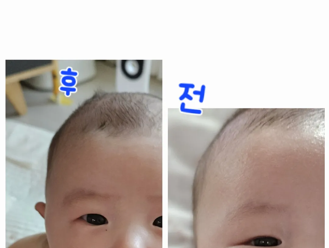 아기 머리 콩했는데 둔한 엄마는 뒤늦게 고민돼요ㅜㅠ