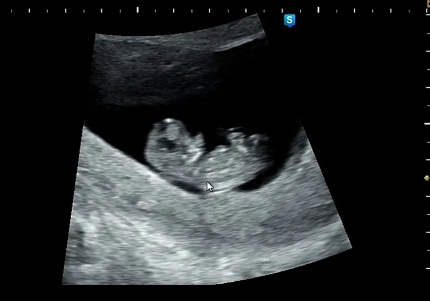 9주6일차 팔다리 뿅-!!!ㅎㅎ