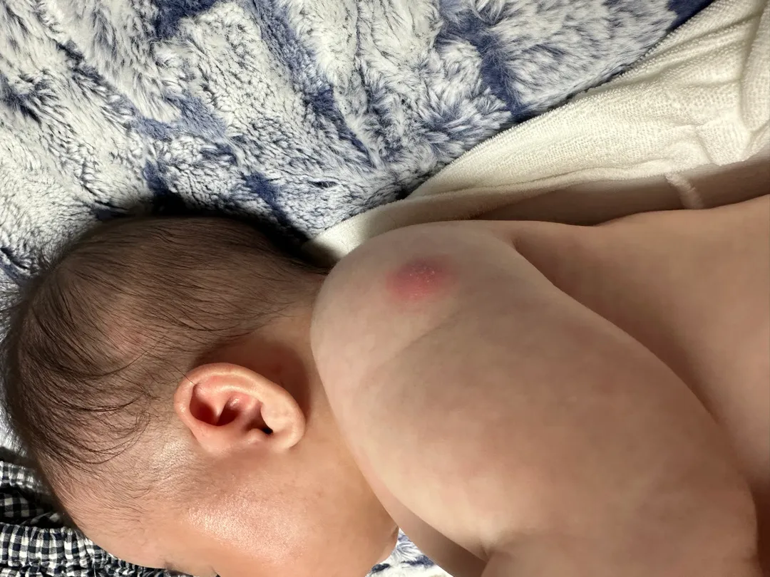 안녕하세요 ㅠㅠ bgc주사 좀 봐주세용