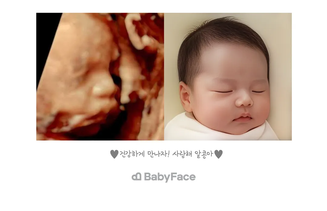 베이비페이스 했어요 !! 