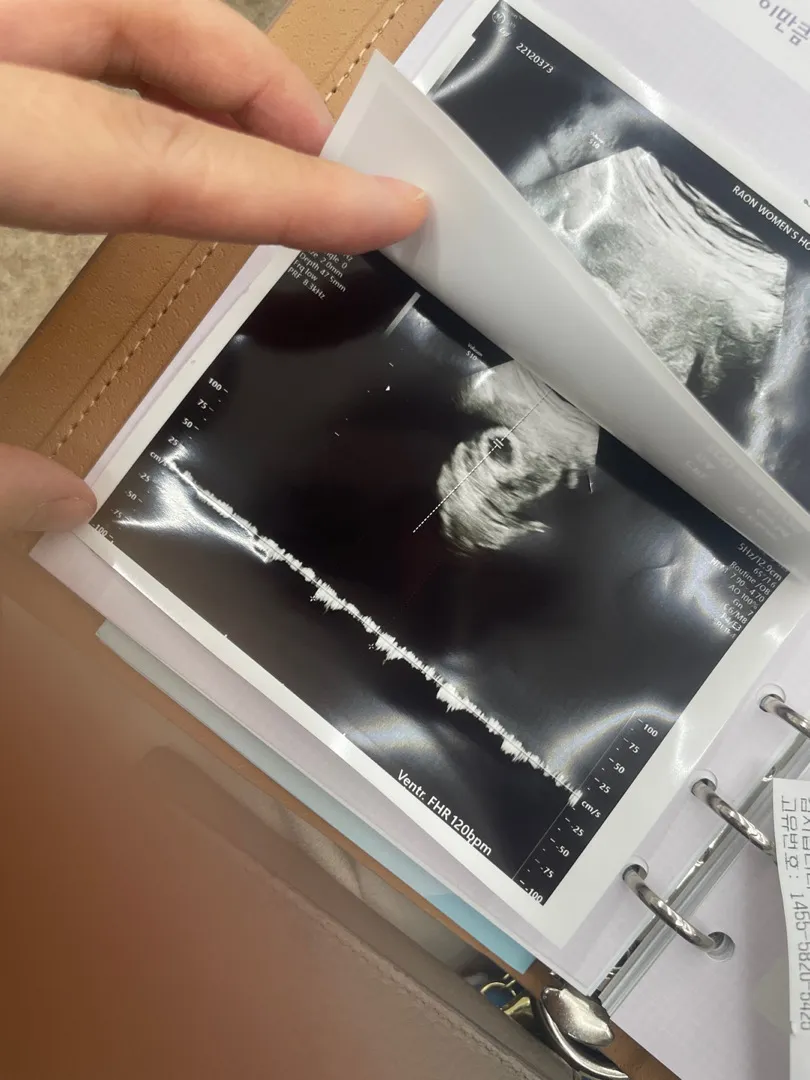 첫 심소❤️ 6w3d