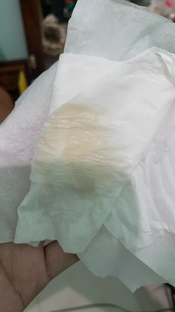 Ketuban atau flek