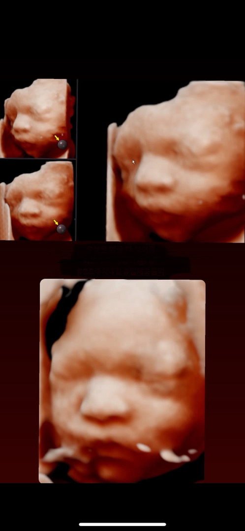 28주 4일👶🏻입체초음파 보고 왔어요ㅎㅎ