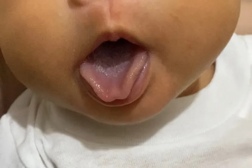 Lidah bayi