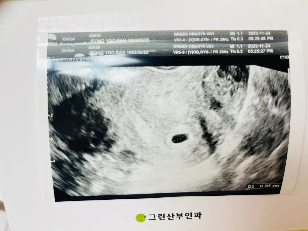초기 엄마인데 불안함만 생기네요