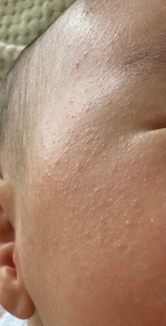 이것도 태열일까요??