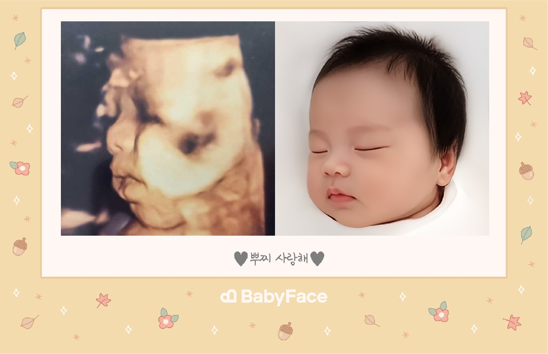 1달을 못참고 베이비페이스 신청해버렸습니다ㅎㅎ