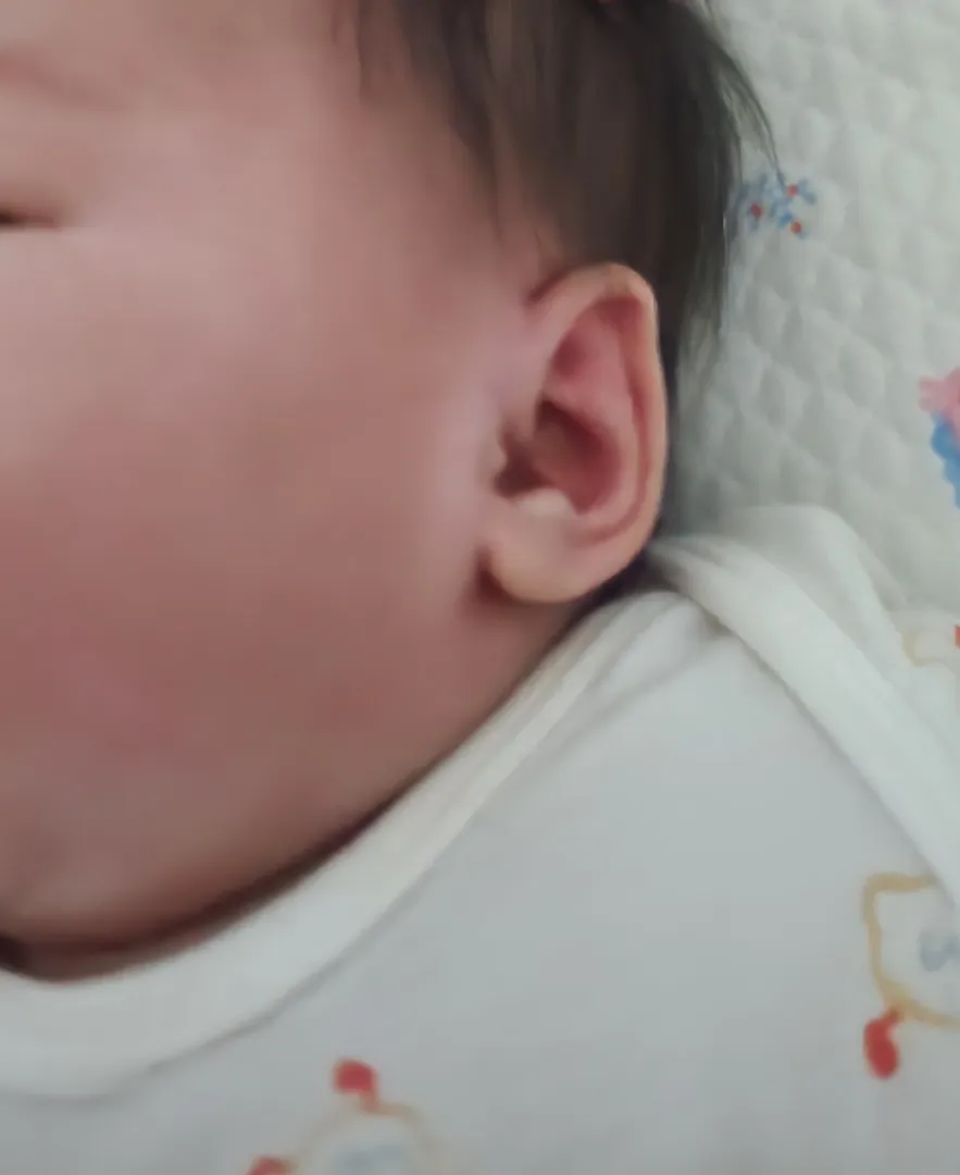 아기 얼굴 옆쪽이 점점 까매져요