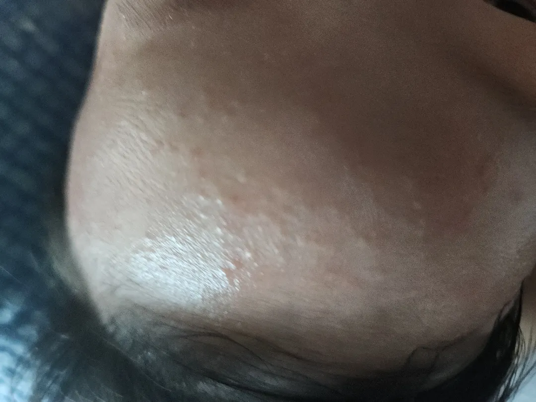 아기 피부좀 봐주세요