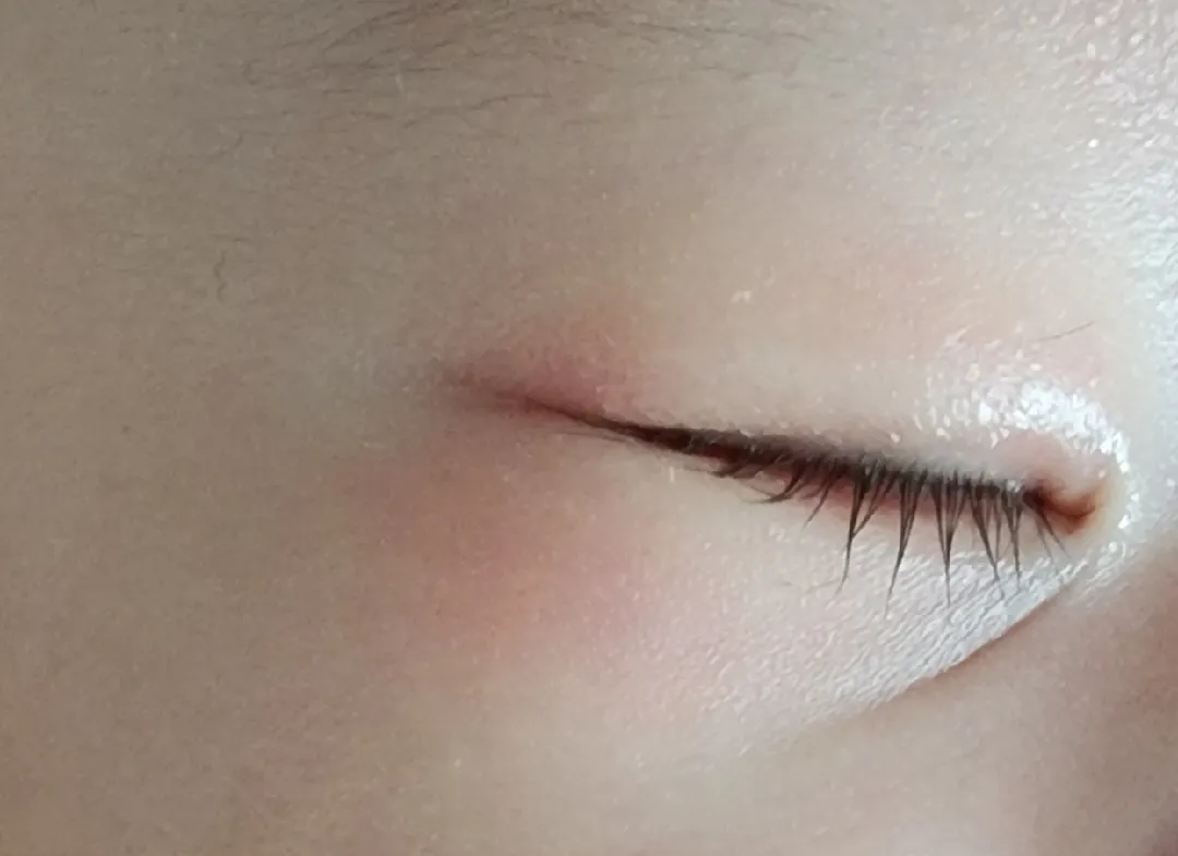 40일 아기눈에 휴대폰 떨어트렸어요ㅠㅠㅠㅠㅠ(사진)