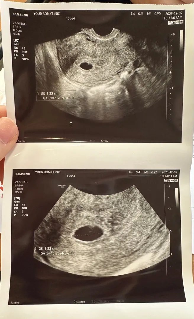 피검사하고 아기집 보고왔어요~