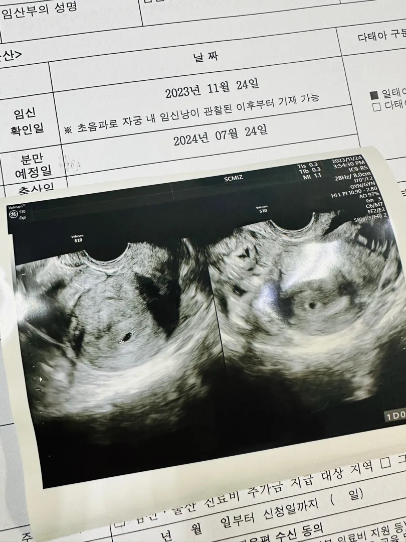 (5주2일)아기집