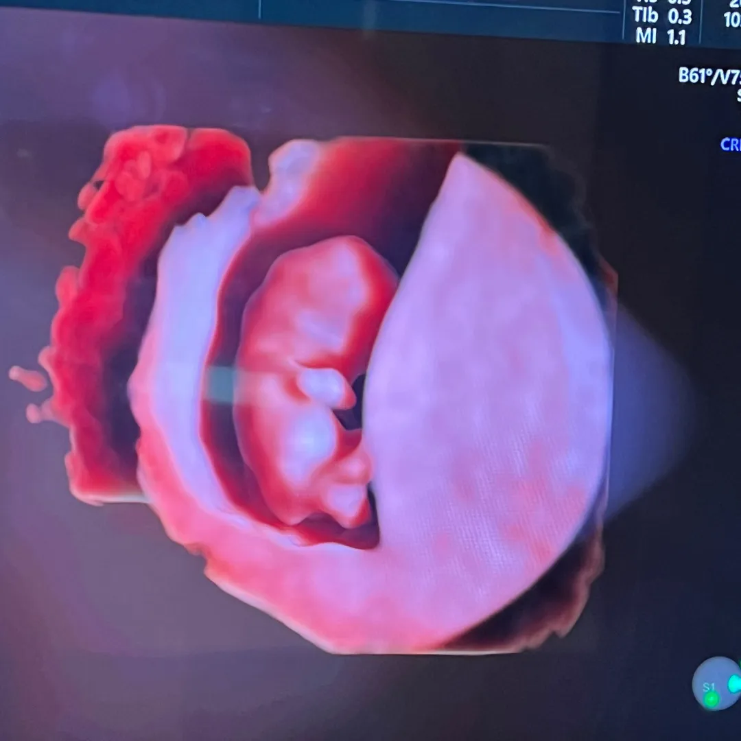 9주차 3D로 젤리곰 보고 왔어요
