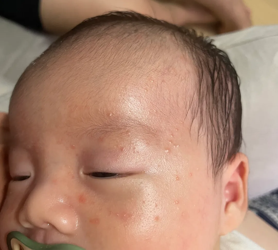 태열... 도와주세요ㅠㅠ