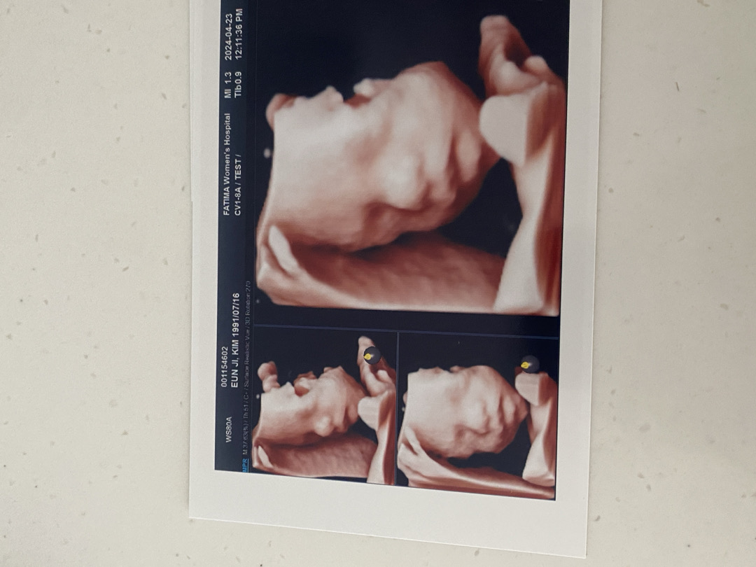 28주2일) 입체초음파 보고 왔어요 🧡