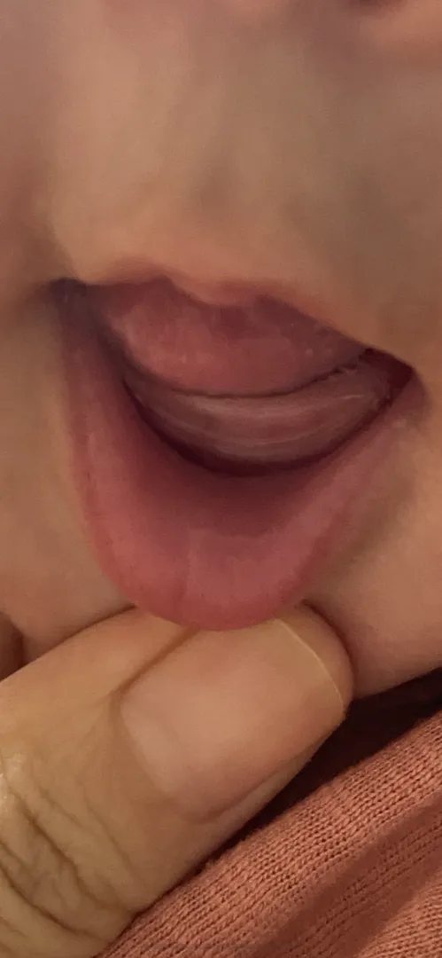 이가 곧 나오는 건 맞지요? 