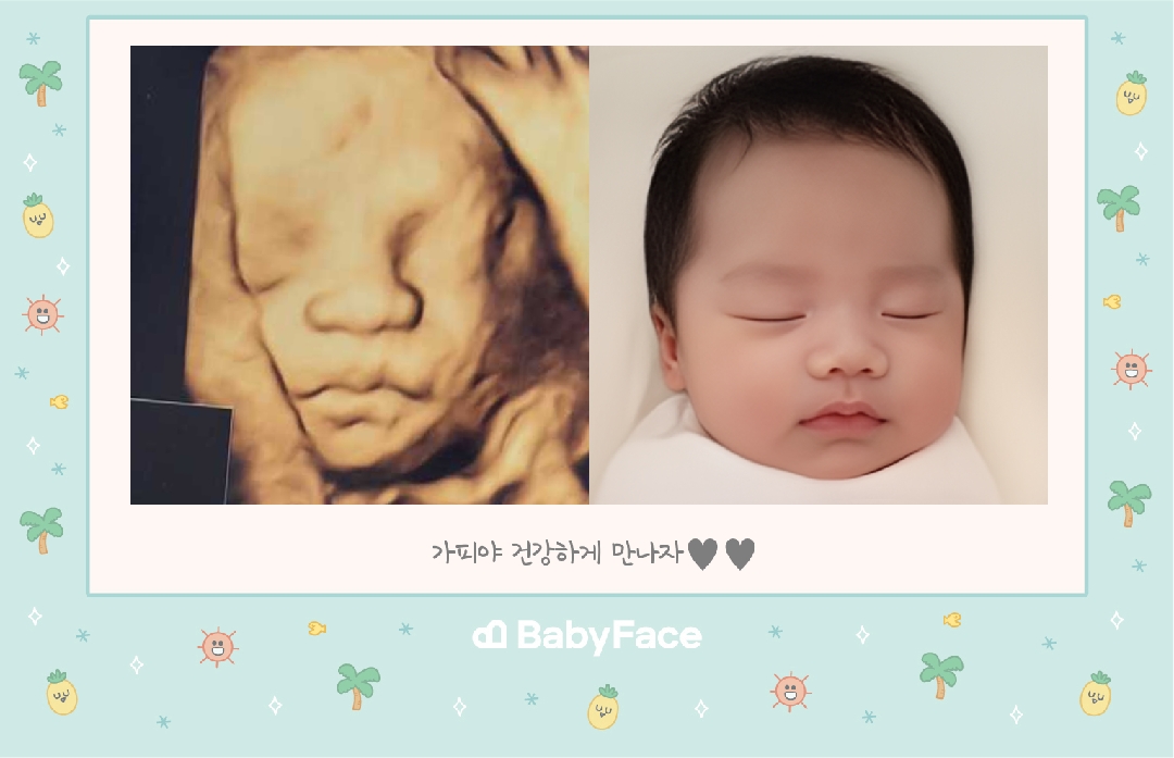 베이비페이스 했는데 너무 신기해요 ㅋㅋㅋㅋ