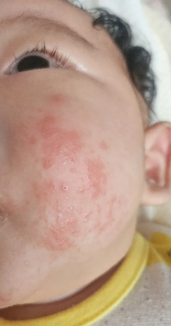 피부 좀 봐주세요!!ㅜㅜ