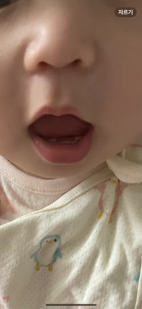 아기 아랫니 좀 봐주세요 ㅠㅠ