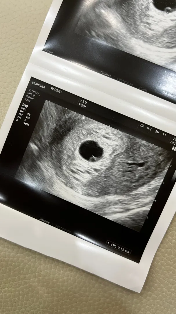 넘나 귀여운 첫 만남
