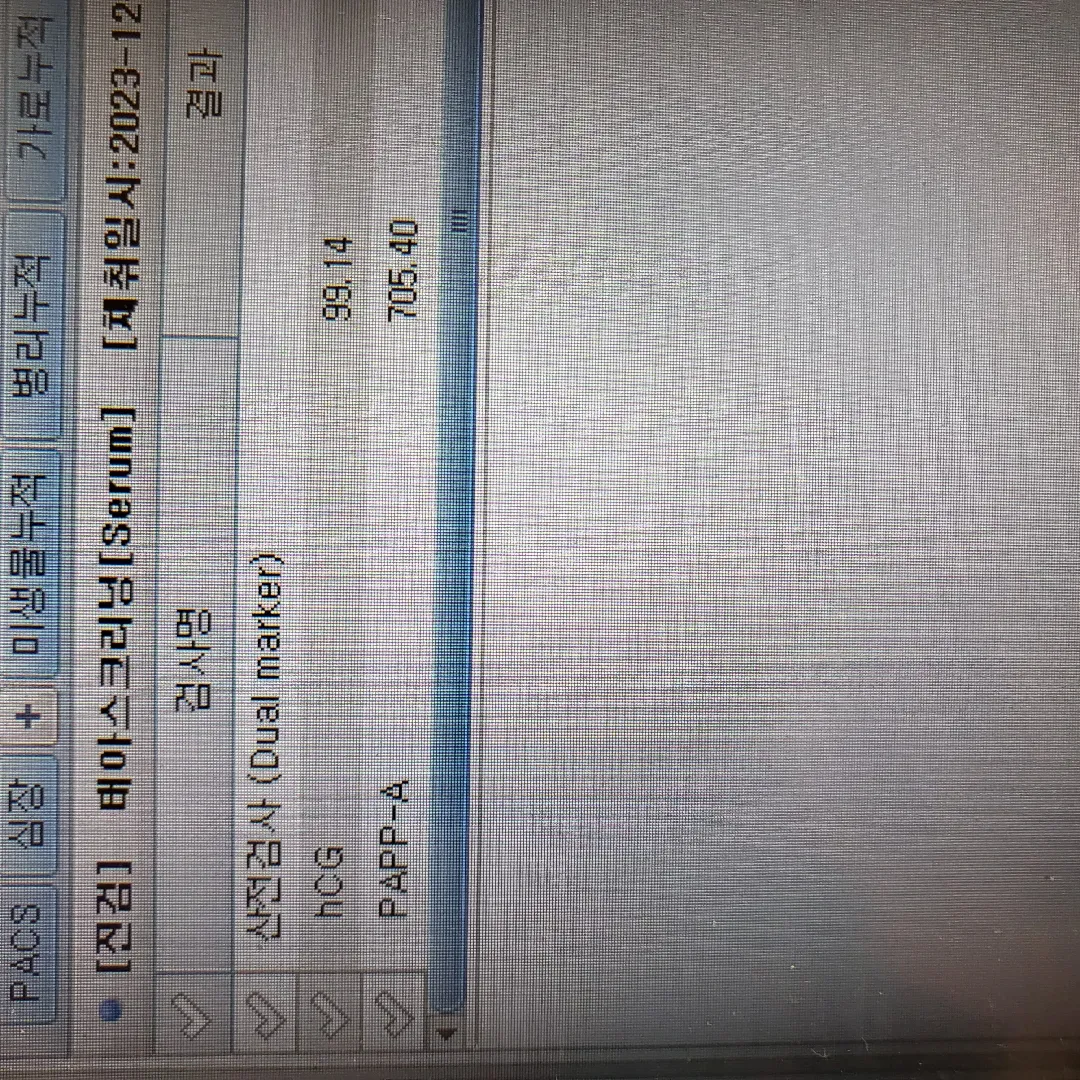 산전 검사 진행했어용 