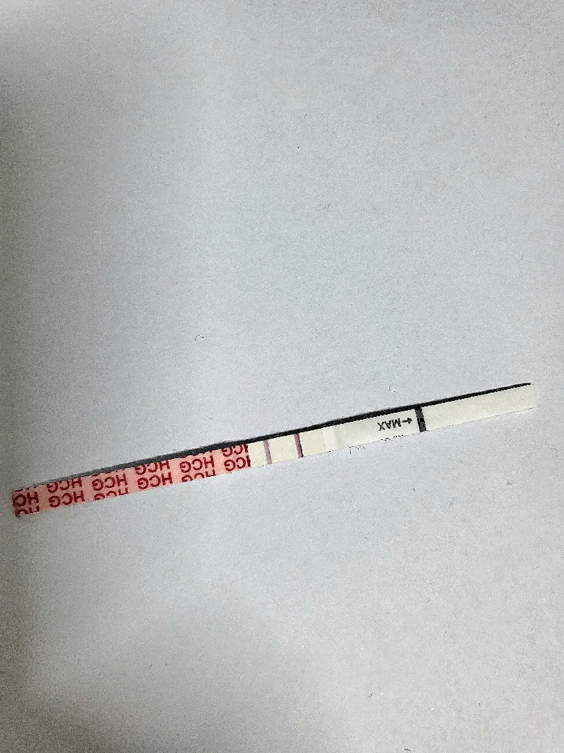 병원안갔는데 다음주쯤가면 심소들을수있을까요?